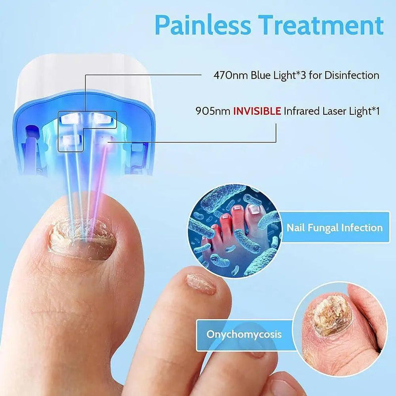 Nail Fungus Laser Treatment Device Repair Toenail Fingernail Fungus Treat Onychomycosis Therapy Cure Machine Effectively Remove - Trhee Minds