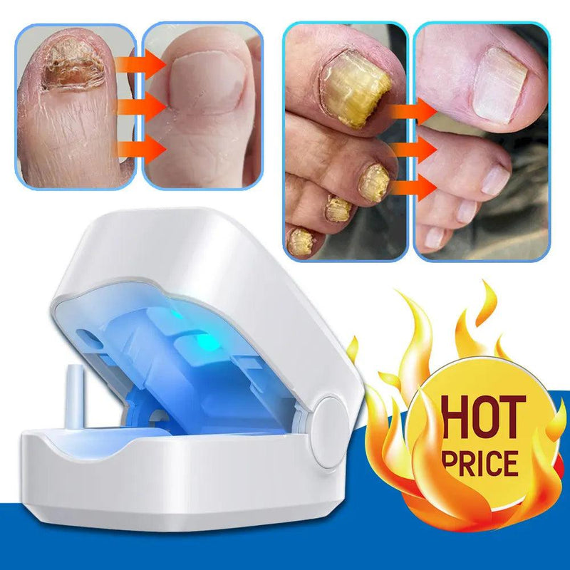 Nail Fungus Laser Treatment Device Repair Toenail Fingernail Fungus Treat Onychomycosis Therapy Cure Machine Effectively Remove - Trhee Minds